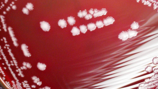 Don't Panic About the 'Black Death Plague'